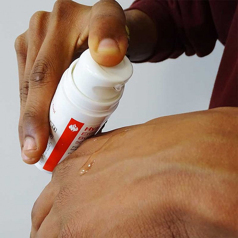 Applying HypaSoothe gel to a minor burn